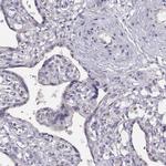 KIF19 Antibody in Immunohistochemistry (IHC)