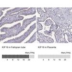 KIF19 Antibody