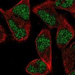 ZNF627 Antibody in Immunocytochemistry (ICC/IF)