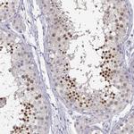 C16orf86 Antibody in Immunohistochemistry (IHC)