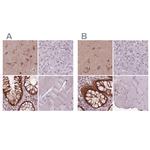 Sorcin Antibody in Immunohistochemistry (IHC)