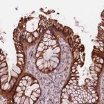 Sorcin Antibody in Immunohistochemistry (IHC)