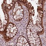 Sorcin Antibody in Immunohistochemistry (IHC)