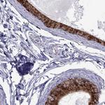 ADAM28 Antibody in Immunohistochemistry (IHC)