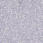 ADAM28 Antibody in Immunohistochemistry (IHC)