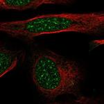 GTF2H4 Antibody in Immunocytochemistry (ICC/IF)