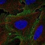 IL12RB1 Antibody in Immunocytochemistry (ICC/IF)