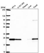 RAB8B Antibody in Western Blot (WB)