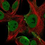 SGCE Antibody in Immunocytochemistry (ICC/IF)