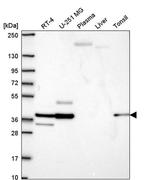 SGCE Antibody in Western Blot (WB)