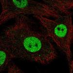 RFWD3 Antibody in Immunocytochemistry (ICC/IF)