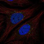 STEAP4 Antibody in Immunocytochemistry (ICC/IF)