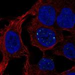 SH3BGRL3 Antibody in Immunocytochemistry (ICC/IF)