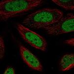 ZBTB6 Antibody in Immunocytochemistry (ICC/IF)