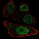 ETV1 Antibody in Immunocytochemistry (ICC/IF)