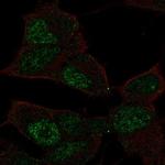 TCF9 Antibody in Immunocytochemistry (ICC/IF)