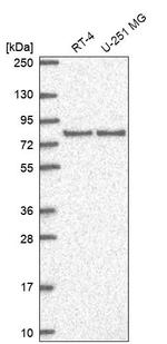 SAP102 Antibody in Western Blot (WB)