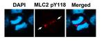 Phospho-MYL2 (Tyr118) Antibody in Immunocytochemistry (ICC/IF)