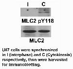 Phospho-MYL2 (Tyr118) Antibody in Western Blot (WB)