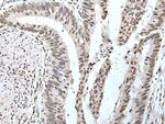 POT1 Antibody in Immunohistochemistry (Paraffin) (IHC (P))