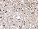 TRIM27 Antibody in Immunohistochemistry (Paraffin) (IHC (P))