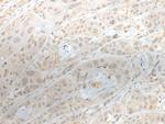 ZNF238 Antibody in Immunohistochemistry (Paraffin) (IHC (P))