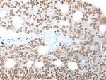 WHSC2 Antibody in Immunohistochemistry (Paraffin) (IHC (P))