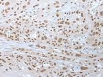 WHSC2 Antibody in Immunohistochemistry (Paraffin) (IHC (P))