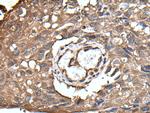 UBE2D3 Antibody in Immunohistochemistry (Paraffin) (IHC (P))