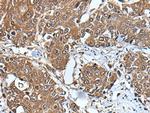 UBE2D3 Antibody in Immunohistochemistry (Paraffin) (IHC (P))