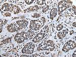 ATAD1 Antibody in Immunohistochemistry (Paraffin) (IHC (P))