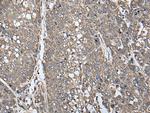 ATAD1 Antibody in Immunohistochemistry (Paraffin) (IHC (P))