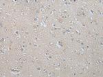 MAGEB5 Antibody in Immunohistochemistry (Paraffin) (IHC (P))