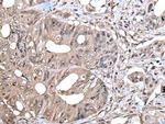 Zyxin Antibody in Immunohistochemistry (Paraffin) (IHC (P))