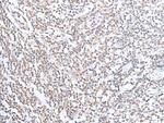 ECT2 Antibody in Immunohistochemistry (Paraffin) (IHC (P))