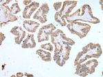 ABCD1 Antibody in Immunohistochemistry (Paraffin) (IHC (P))