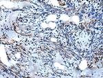 WIPF1 Antibody in Immunohistochemistry (Paraffin) (IHC (P))