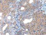 UNC5B Antibody in Immunohistochemistry (Paraffin) (IHC (P))