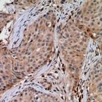 UBE2G1 Antibody in Immunohistochemistry (Paraffin) (IHC (P))