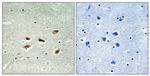 p39 Antibody in Immunohistochemistry (Paraffin) (IHC (P))