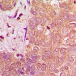 NAV1 Antibody in Immunohistochemistry (Paraffin) (IHC (P))