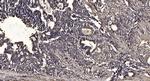 STK38L Antibody in Immunohistochemistry (Paraffin) (IHC (P))