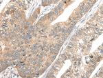 CA7 Antibody in Immunohistochemistry (Paraffin) (IHC (P))