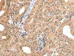 CA7 Antibody in Immunohistochemistry (Paraffin) (IHC (P))