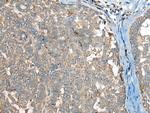 CCT6B Antibody in Immunohistochemistry (Paraffin) (IHC (P))