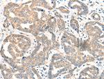 CDK2AP1 Antibody in Immunohistochemistry (Paraffin) (IHC (P))