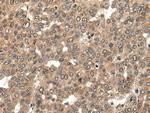 L1RE1 Antibody in Immunohistochemistry (Paraffin) (IHC (P))