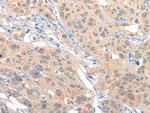 MIIP Antibody in Immunohistochemistry (Paraffin) (IHC (P))