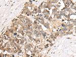 TSEN15 Antibody in Immunohistochemistry (Paraffin) (IHC (P))