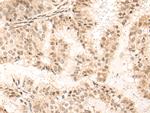 UTY Antibody in Immunohistochemistry (Paraffin) (IHC (P))